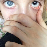 Stung0