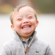 The 21st chromosome
