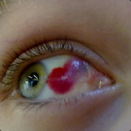 DieGummihand