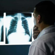 X RAY