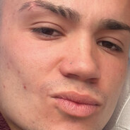BARRI