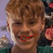 Tooth 3