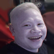 Albino J𝔬𝔫𝔢𝔩 ✨