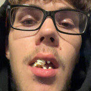 skinnypeen