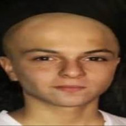 OscuPelado