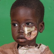 Kid with acidhead