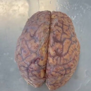 Cerebrum