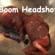 Aborted Fetus