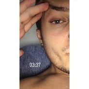 1hangover