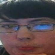 Anus01