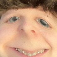 F0xzY