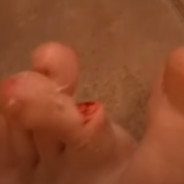 OH NO! MY BROKEN TOE...™