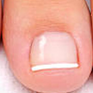 toe