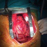 SurgeonOfHEART**