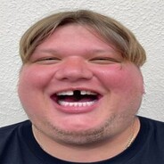 Sn1mple