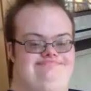 Edward AIDS