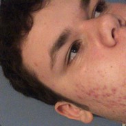 Grimpf