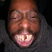 dirty homeless man