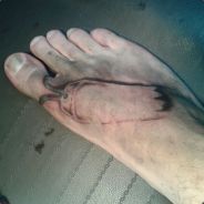 ToeTag