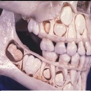 IDDQD-(wakala)