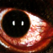 bono