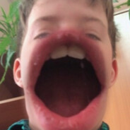 Acerman