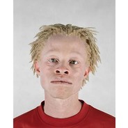 AlbinoZenci